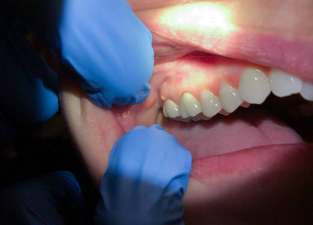Best Emergency Cosmetic Dentistry in Strathmore, NJ
