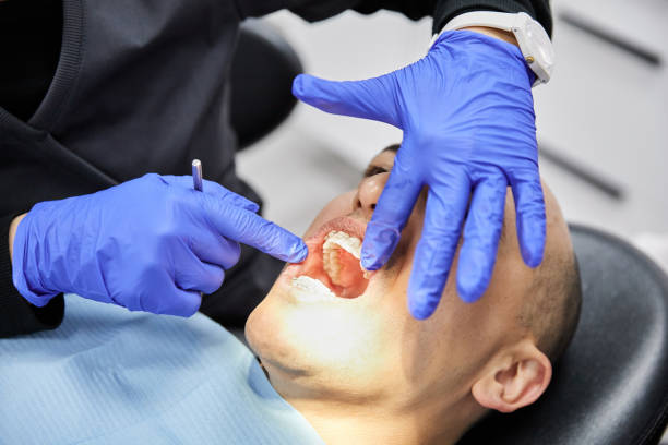 Best Emergency Dental Care for Abscessed Tooth in Strathmore, NJ